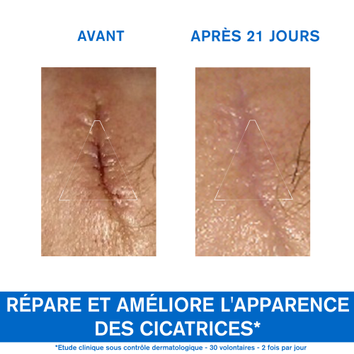 Uriage Bariéderm Cica-Crème Réparatrice 40 ml