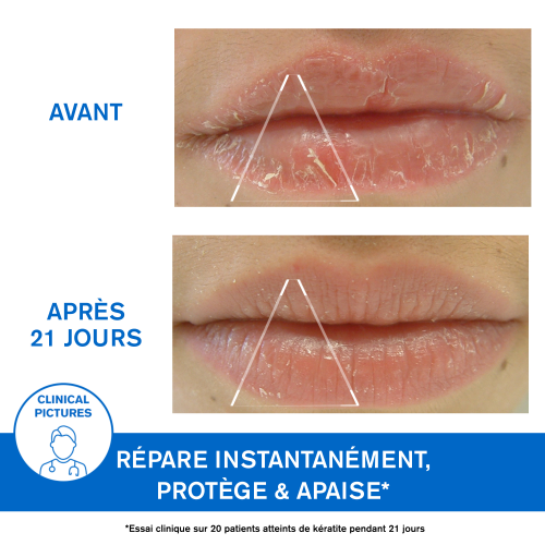 Uriage Bariéderm Cica-Lèvres Baume Protecteur 15 ml
