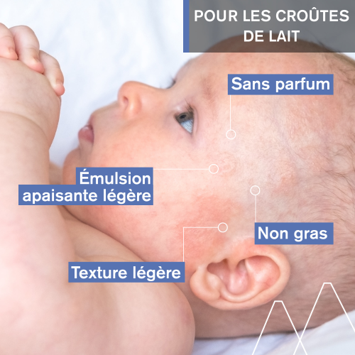 Uriage Bébé 1er Soin Croûtes de Lait 40 ml