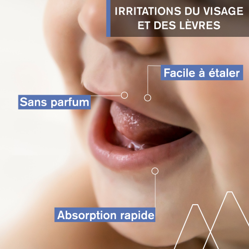 Uriage Bébé 1er Soin Péri-Oral 30 ml