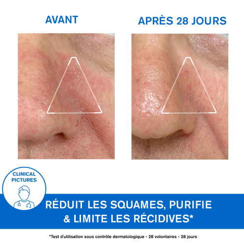 Uriage D.S. Émulsion 40 ml