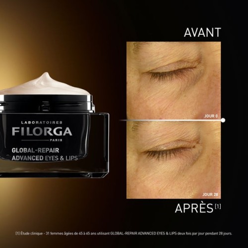 Filorga Global-Repair Eyes & Lips Contour Yeux & Lèvres Multi-Revitalisant 15 ml