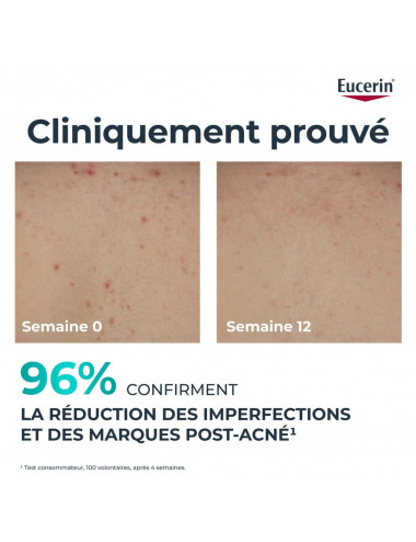 Eucerin DermoPure Crème Corps Triple Effet Anti-Imperfections – 200 ml