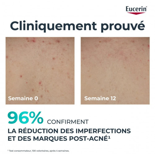 Eucerin DermoPure Crème Corps Triple Effet Anti-Imperfections – 200 ml