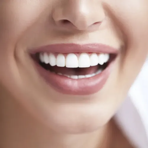 Sanogyl Brosse à Dents Interdentaire Souple